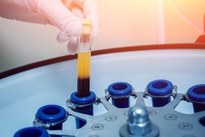 Regenerative Medicine at Colorado Sports Medicine & Orthopaedics