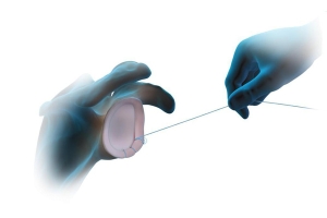 Shoulder Instability in Athletes - Part I