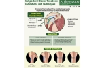 Biceps Tendon Injuries: How to Treat