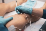 Does Dry Needling Reduce Pain after ACL Reconstruction?