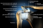 PRP for Shoulder Pain