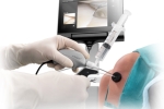 What is Office Needle Arthroscopy? Is it Right for me?